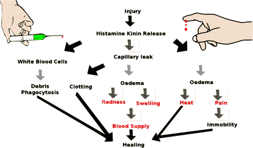 Imagem de vetor de esquema de inflamação