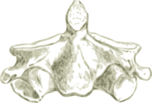 Spina dorsale cervicale