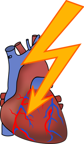 Symbol för hjärtinfarkt vektorritning