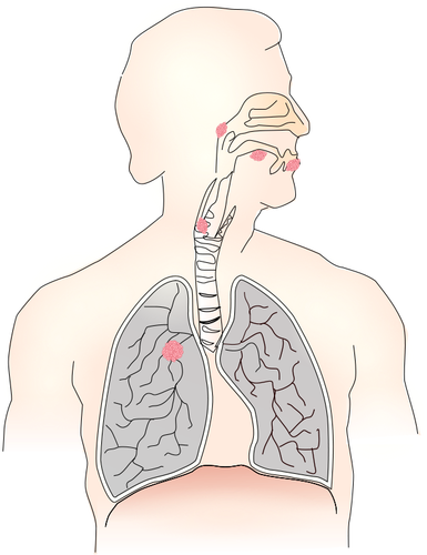 Simbolo per immagine vettoriale di cancro del polmone