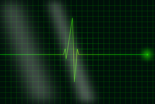 Wektorowa elektrokardiogram