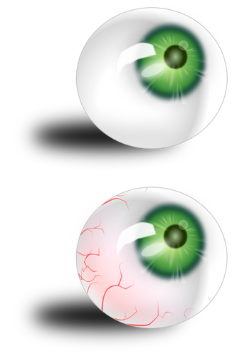 Globo ocular verde