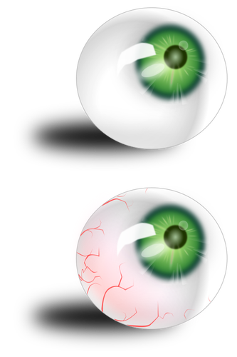 Green eyeball