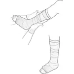Ilustração em vetor de exame de perna engessada