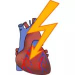 Simbolo per il disegno vettoriale di attacco di cuore